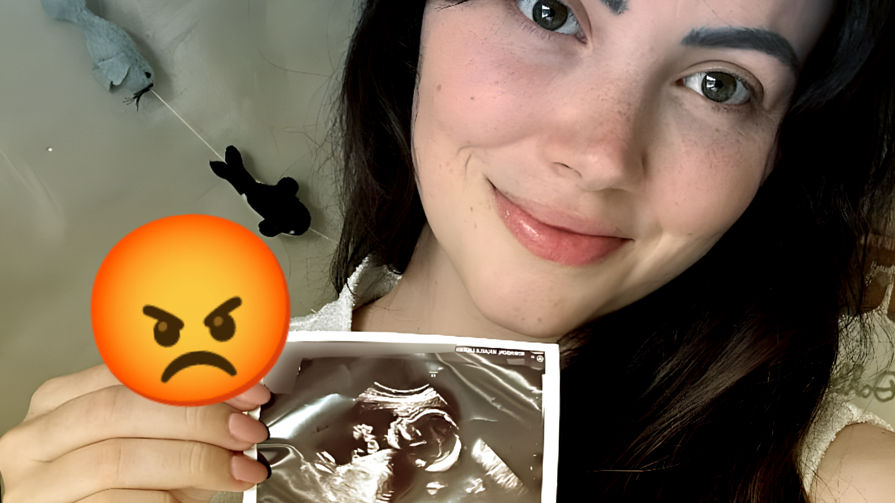 Scandaloso annuncio di gravidanza: l'ecografia di una mamma finisce nel finto pancione di una celebrità danese legata a Tommy Fury!