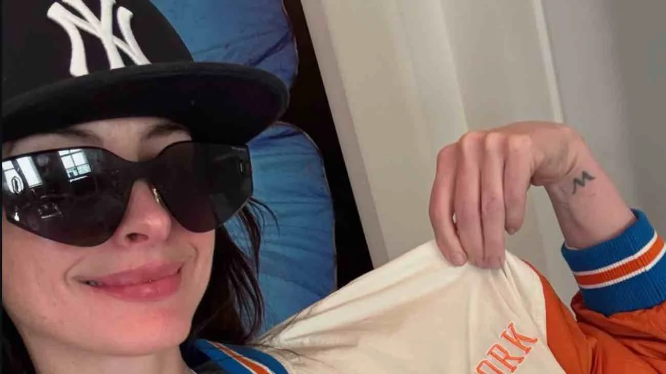 Anna Hathaway dramma all'occhio